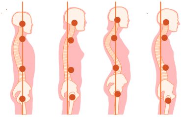 types-of-spine
