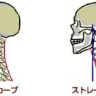 ストレートネックとは？整骨院での治療と原因を解説！